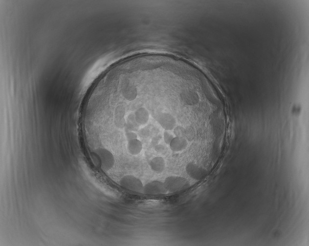 X0000114720151200911121740