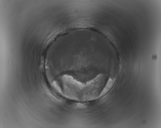 X0000114720166200911121740