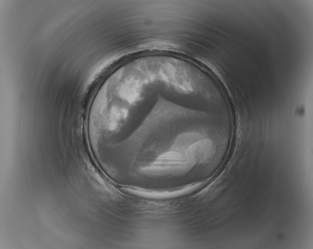 X0000114721115200911121726