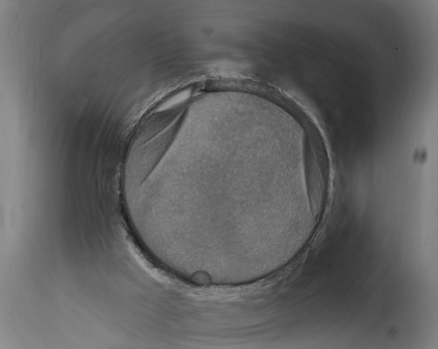 X0000114720009200911181415