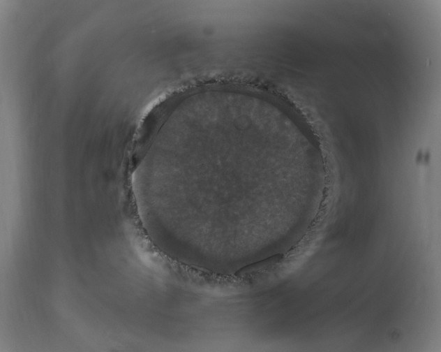 X0000114720144200911181413