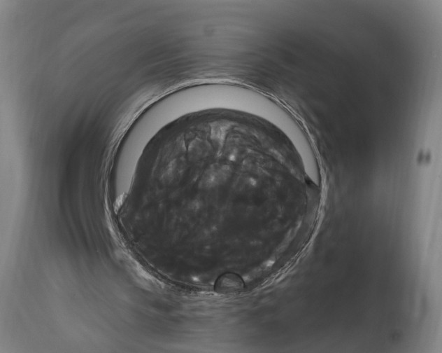 X0000114720145200911181412