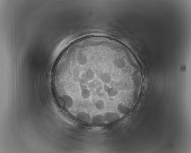 X0000114720151200911181412