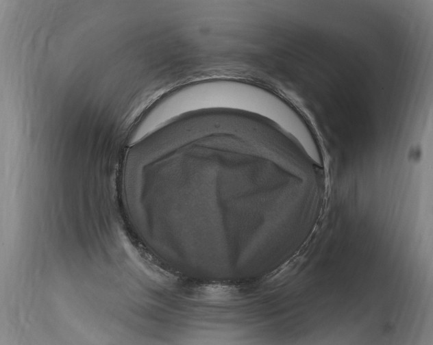 X0000114720154200911181412