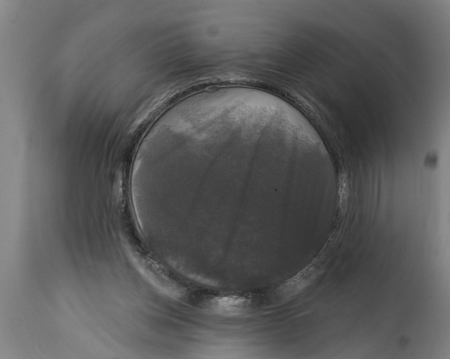 X0000114720158200911181412