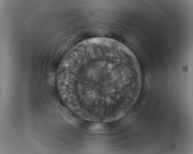 X0000114720177200911181413