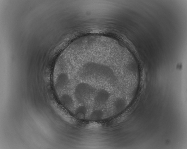 X0000114720257200911181411