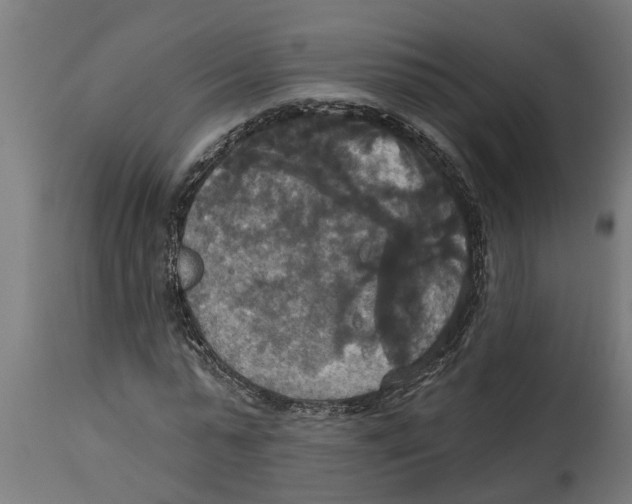 X0000114720775200911181403