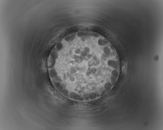 X0000114720819200911181402