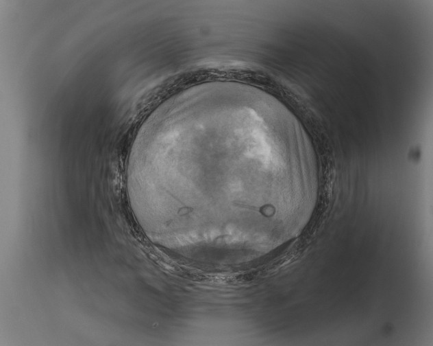 X0000114720966200911181400