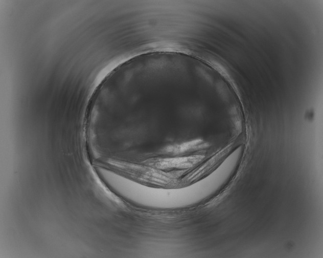 X0000114721141200911181358