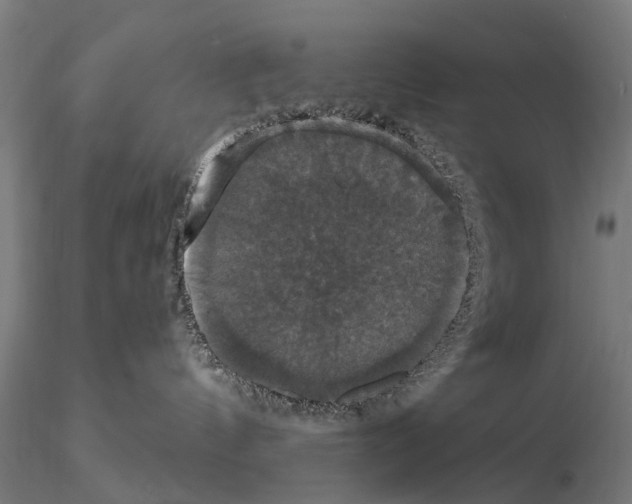 X0000114720144200912021203