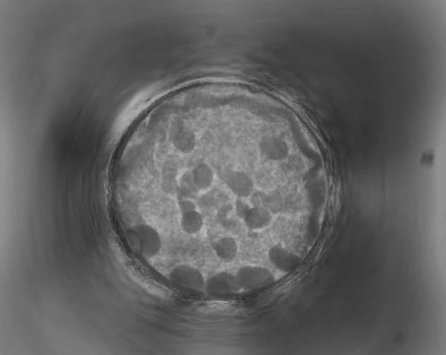 X0000114720151200912021203