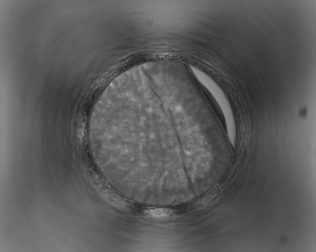 X0000114720417200912021159