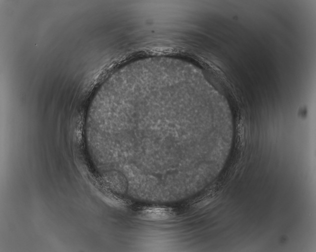 X0000114720499200912021158