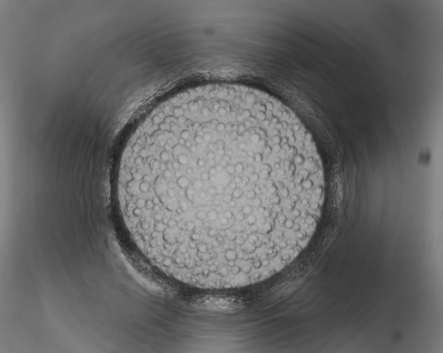 X0000114720638200912021155