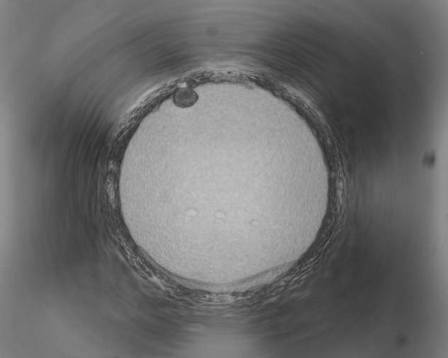 X0000114720968200912021151