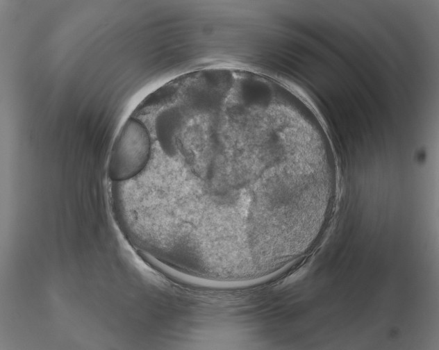 X0000114721149200912021148