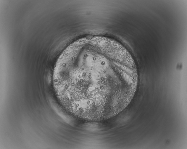 X0000114990069200911161523