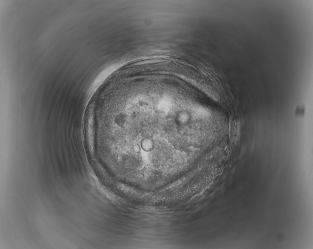 X0000114990147200911161521