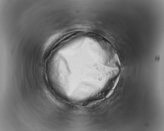 X0000114990149200911161521