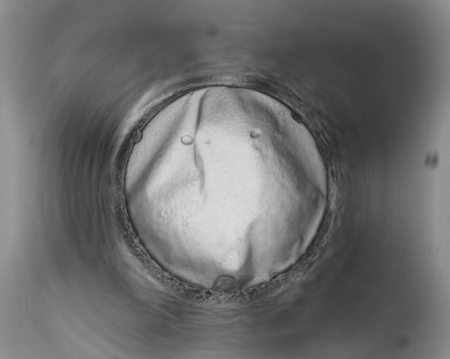 X0000114990198200911161521