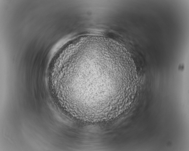 X0000114990294200911161520