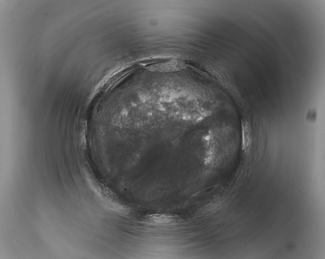 X0000114990300200911161520