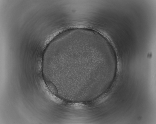 X0000114990393200911161518