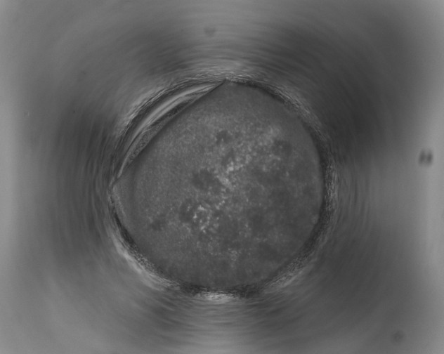 X0000114990590200911161515