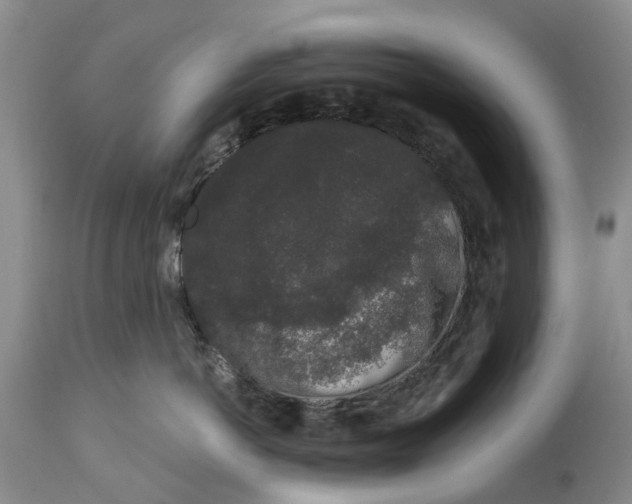 X0000114990766200911161513