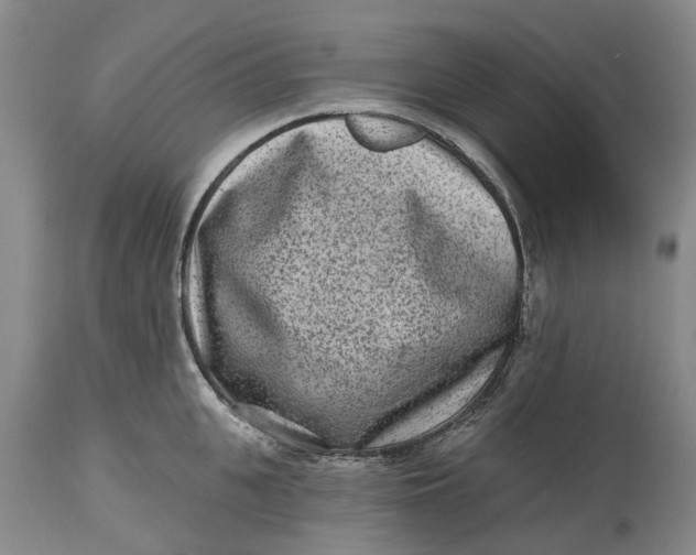 X0000114990951200911161510