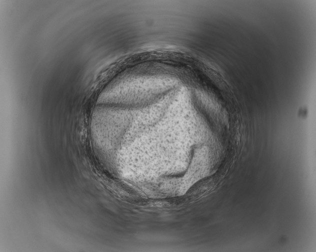 X0000114990966200911161510