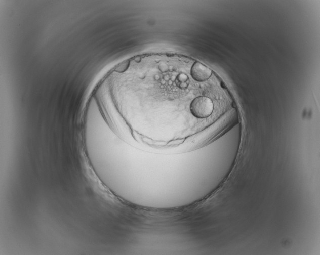 X0000114991008200911161509