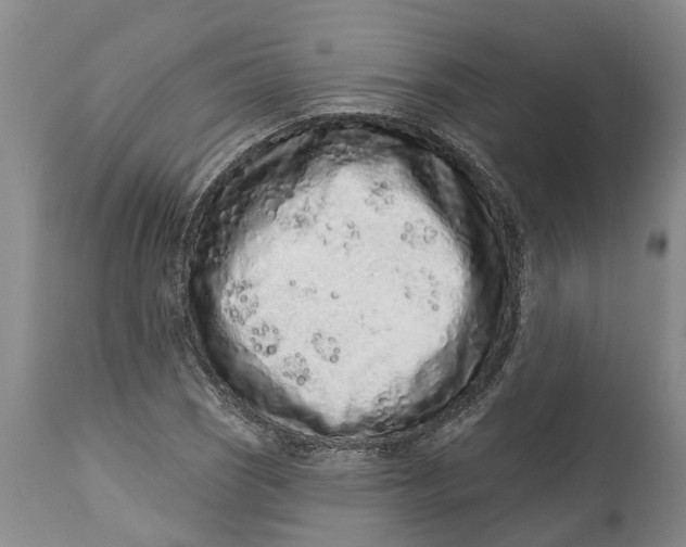 X0000114991121200911161507