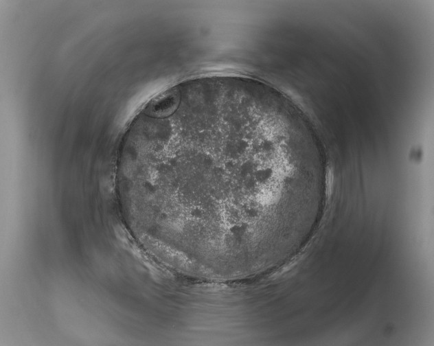 X0000114991405200911161503