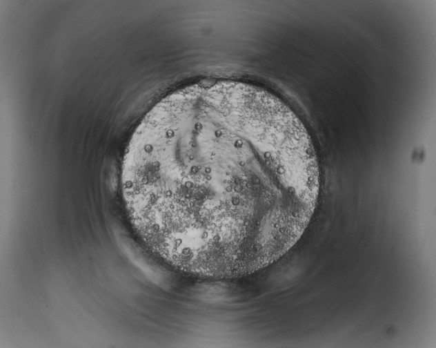 X0000114990069200911231151