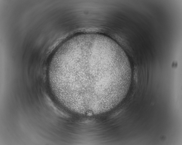 X0000114990206200911231149