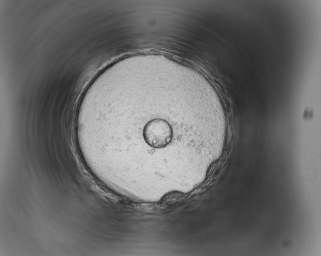 X0000114990241200911231148