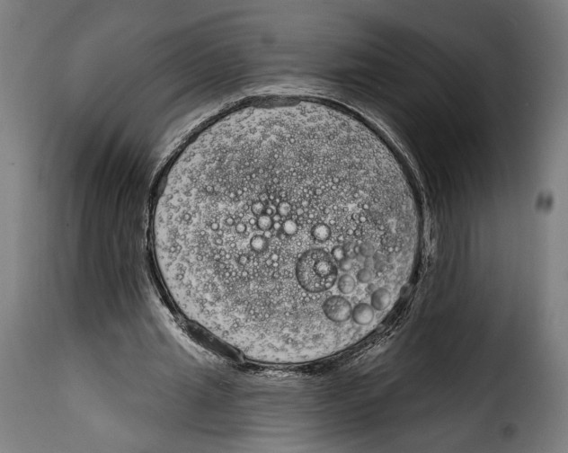 X0000114990437200911231145