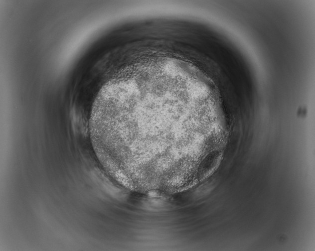 X0000114990479200911231145