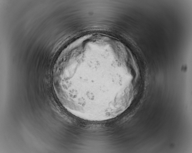 X0000114991121200911231135