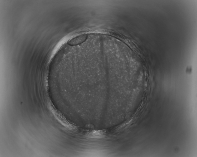 X0000114990056200912071126