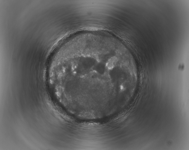 X0000114990304200912071123