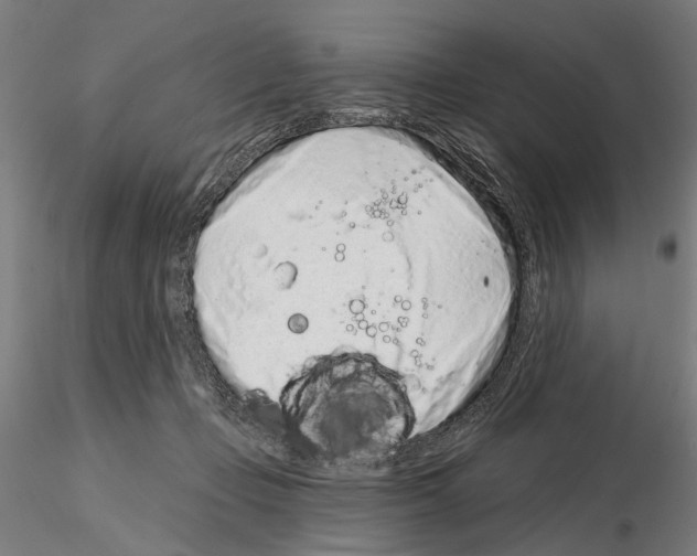 X0000114990365200912071122