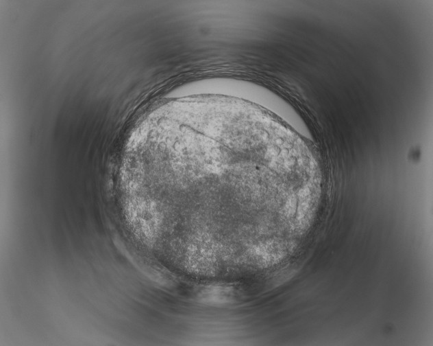 X0000114990366200912071122