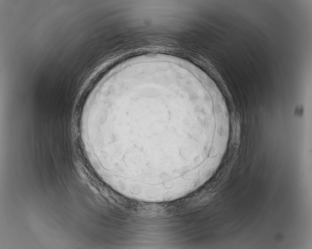 X0000114990435200912071120