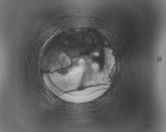 X0000114991009200912071112