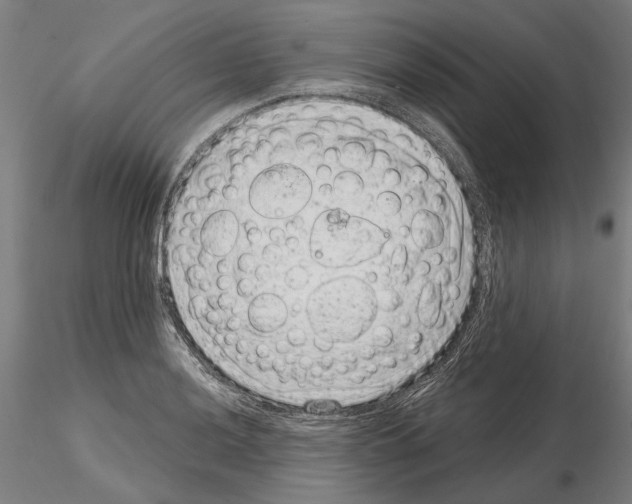 X0000114991036200912071112