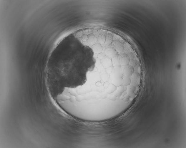 X0000114991432200912071107